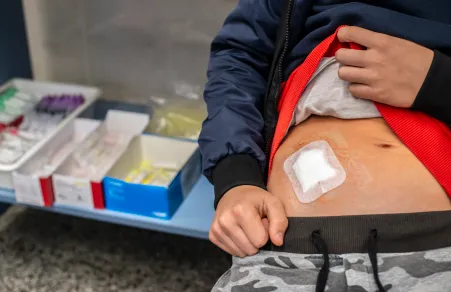 Apendicitis: Qué Debes Saber Sobre Diagnóstico y Tratamiento