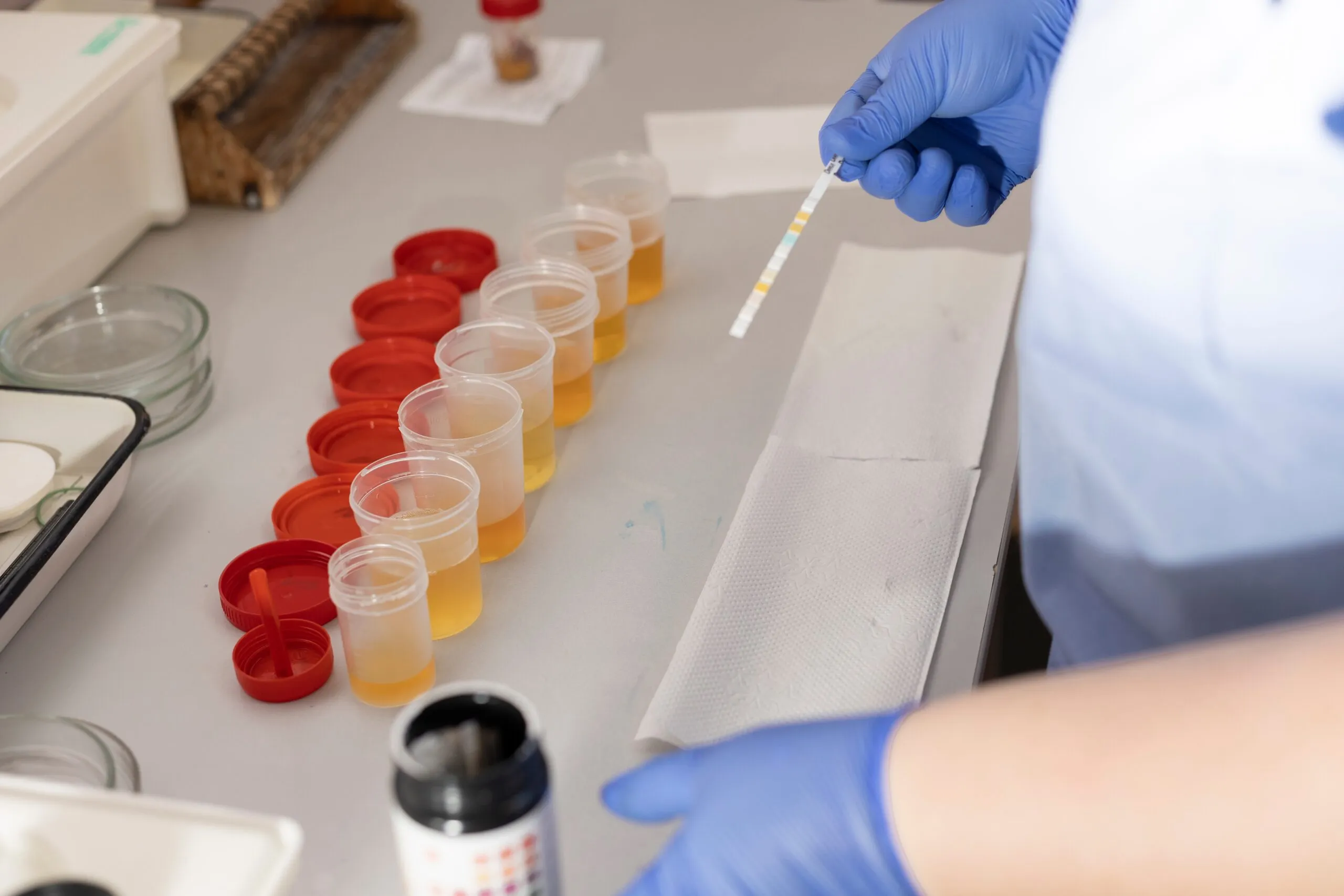 Pruebas de laboratorio inmunología