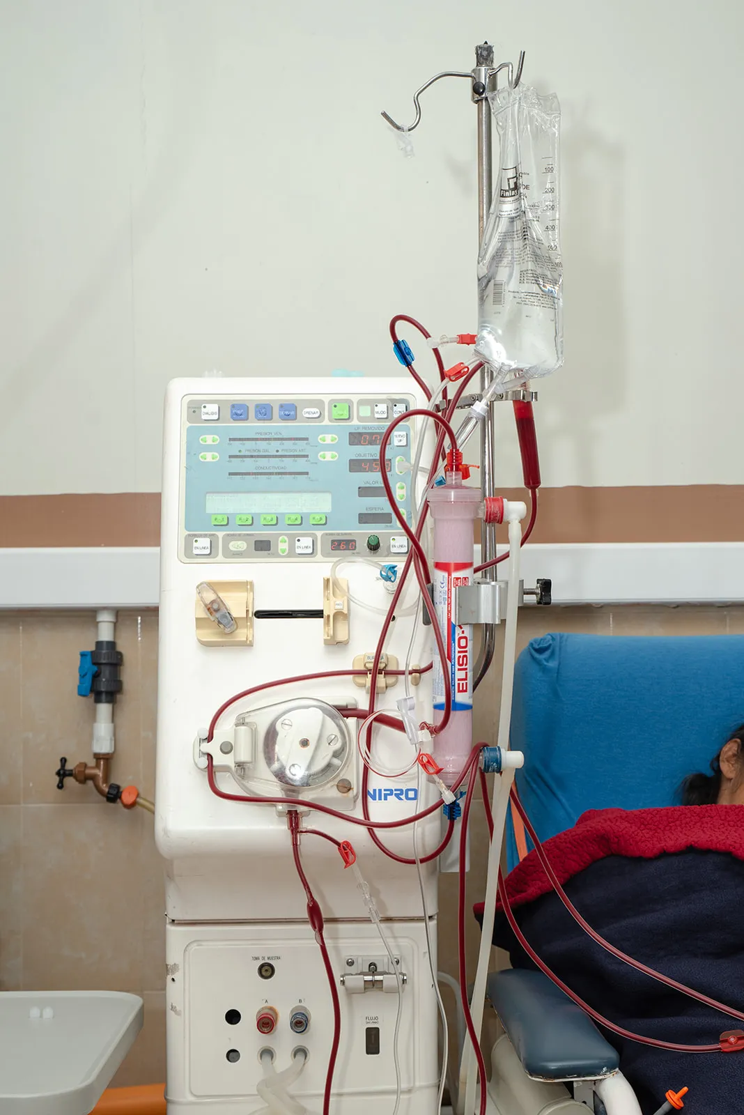 Sala de hemodiálisis Hospital Los Álamos